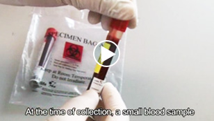 Cord Blood Collection process video